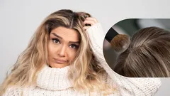 Kuinka piilottaa kasvaneet hiusjuuret: parhaat kampaukset, jotka on helppo tehdä kotona